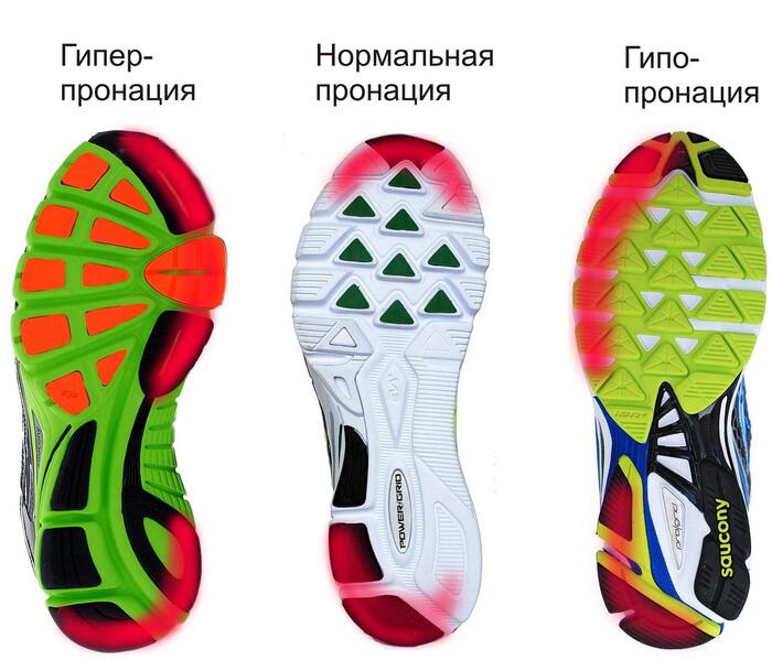 пронация в кроссовках пронация в кроссовках